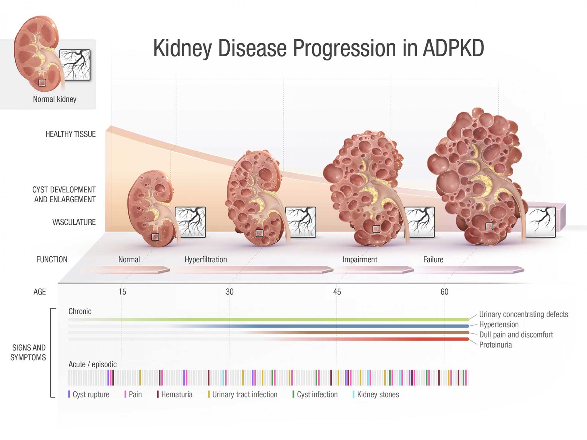 关于猫多囊肾(pkd)你需要知道的