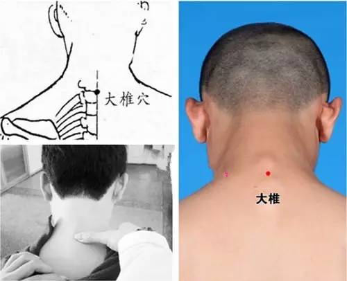 大椎骨在哪个位置图片图片