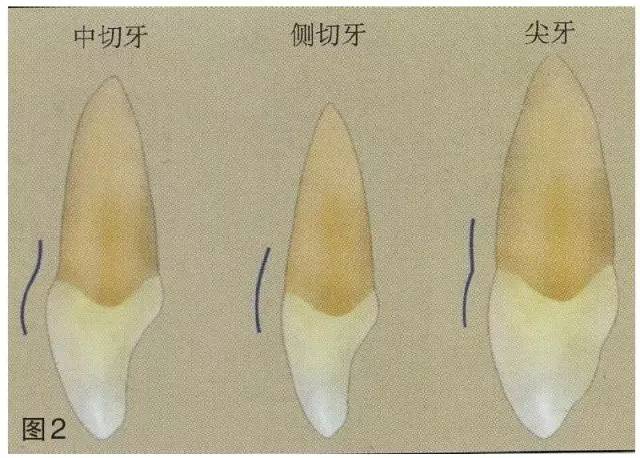 釉牙骨质界图片